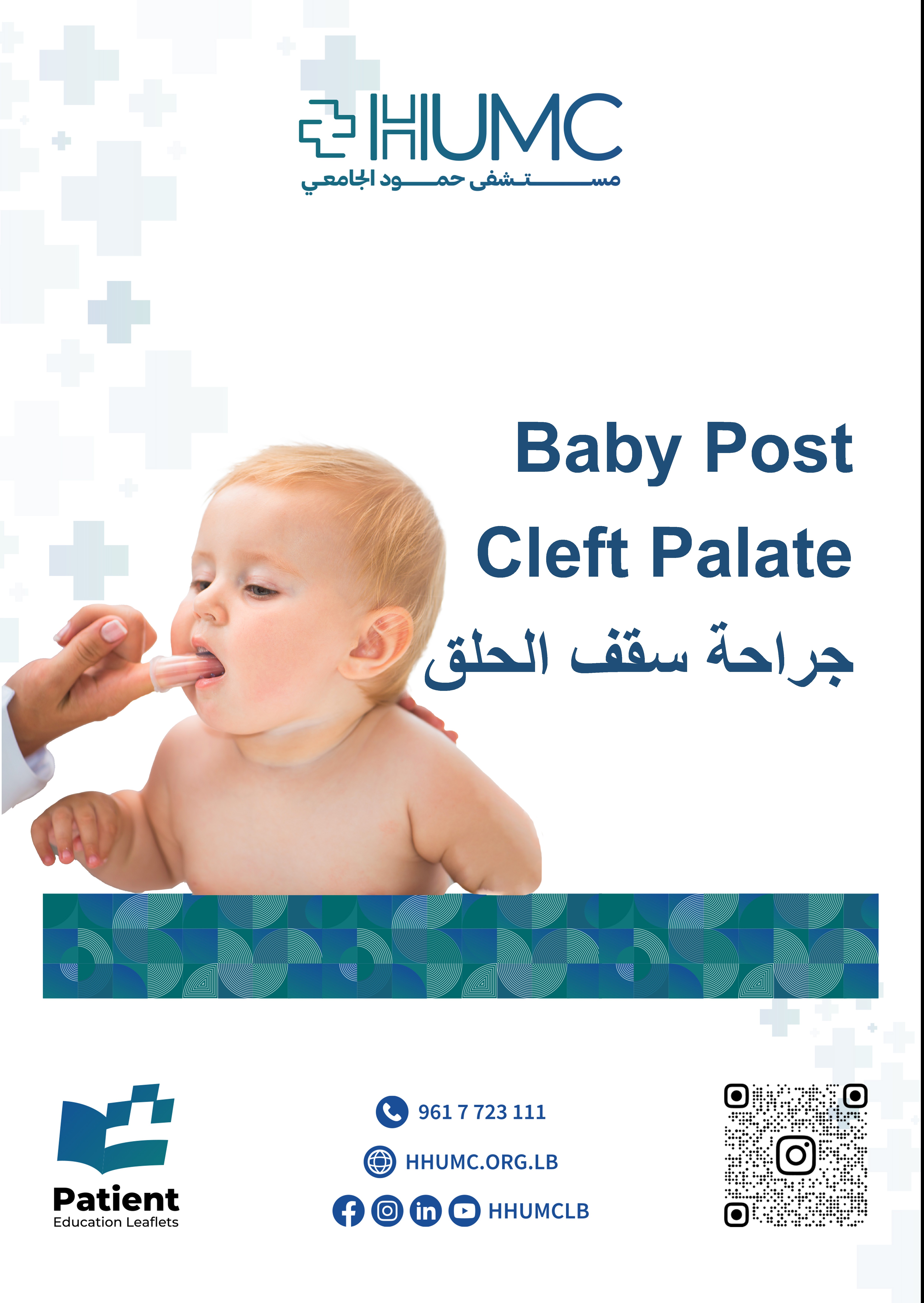 Baby Post Cleft Palate